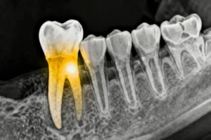 AI Breakthrough Automates Dental Disease Detection Using Advanced Object Recognition - Professional coverage