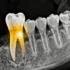 AI Breakthrough Automates Dental Disease Detection Using Advanced Object Recognition