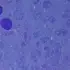 iPSC-derived ITGA6-positive cells restore aqueous humor outflow in glaucoma eyes – Nature Communications
