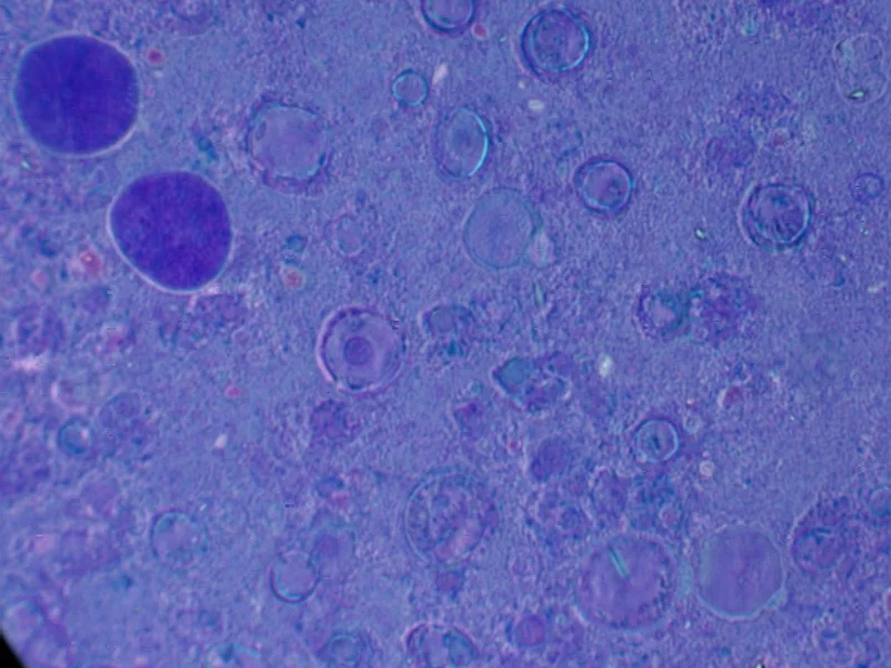 iPSC-derived ITGA6-positive cells restore aqueous humor outf - According to Nature, researchers have discovered that iPSC-der